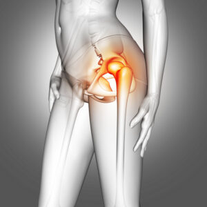 Top 5 Causes Of Hip Pain You Should Know About